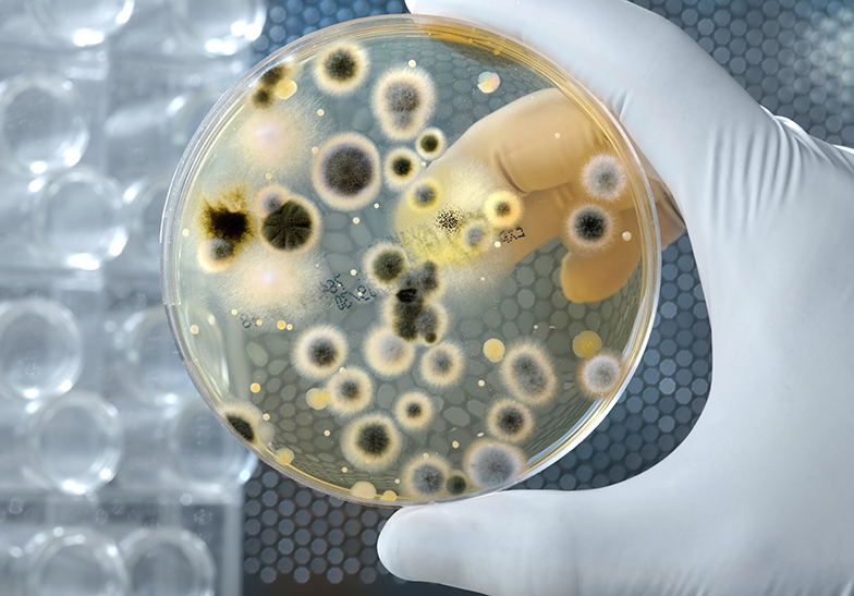 Forschung/Labor/Pilzkultur/Petrischale/Handschuh