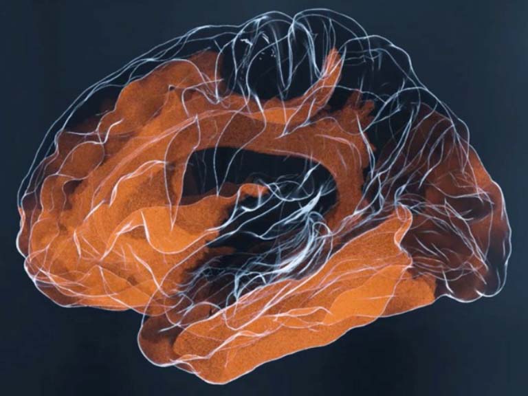 Signalfluss im menschlichen Gehirn Universität Bern