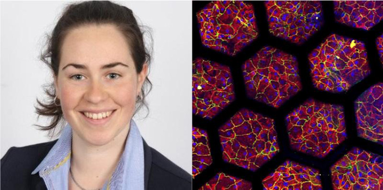 Left: Pauline Zamprogno, Organs-on-Chip Technologies at ARTORG, successfully defended her PhD thesis remotely on 6 April 2020. Right: Microscopy picture of the lung alveoli array developed by Pauline Zamprogno.