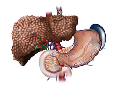 DAS Hepatology