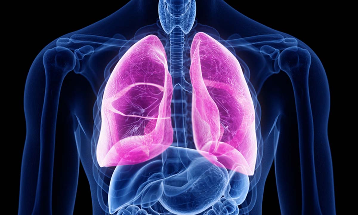 Lungenfibrose: Nach dem Durchlaufen einer erfolgreichen Rehabilitation steigt die langfristige Überlebenswahrscheinlichkeit deutlich.