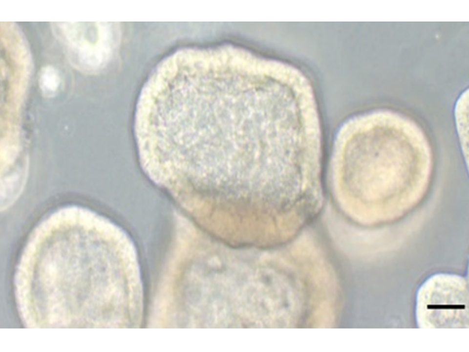 Aufnahme von 3D-Organoid-Kulturen von Ovarialkarzinom-Zellen, die von Patientinnen stammen. Massstabsbalken = 60mm.  Bild: Universität Bern