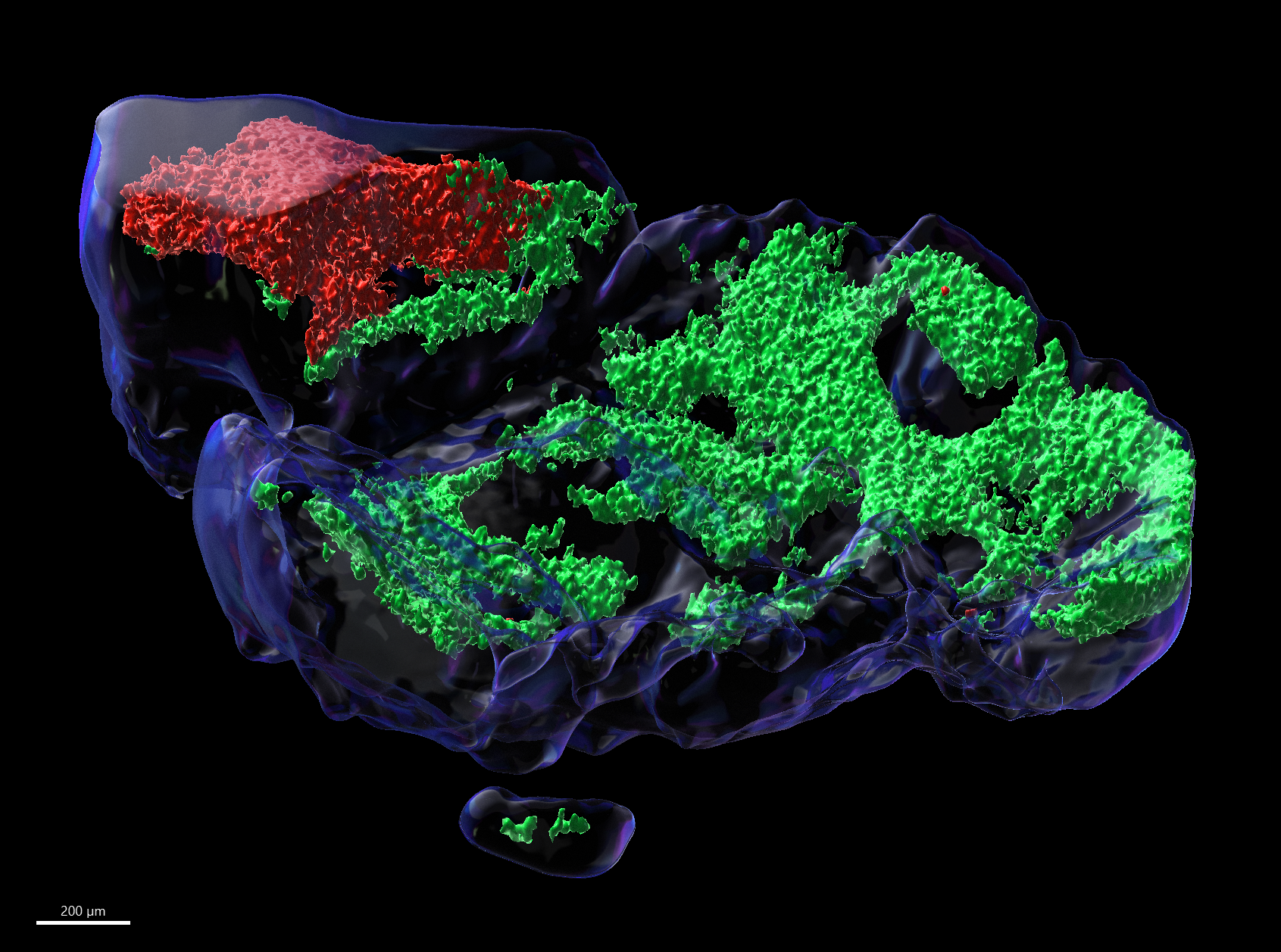 Tumorzellen (rot), die in einer Mikrostruktur (Wirtsgewebe; grün), einem sogenannten Organoid, gezüchtet wurden. Das Labor von Mark Rubin hat Organoide entwickelt, welche die Untersuchung von Patiententumoren auf zellulärer Ebene ermöglichen.