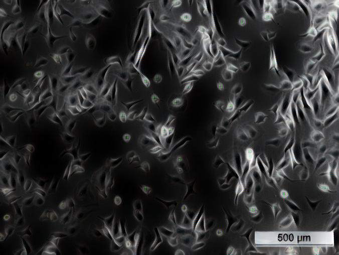 Mikroskop-Bild einer Zell-Linie, die verwendet wird, um lncRNAs zu finden, die Lungenkrebs auslösen. © Taisia Polidori,  Universität Bern