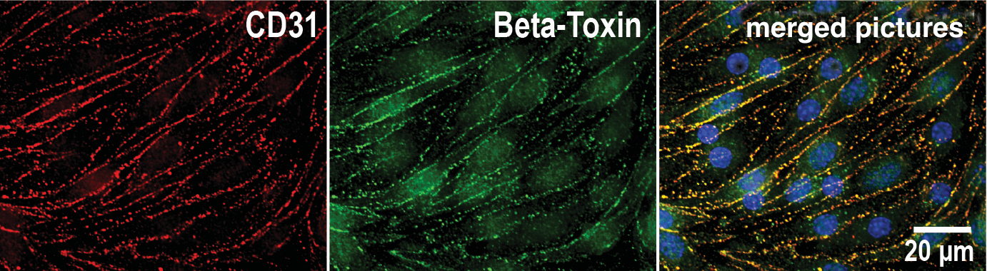 Endothelial cell cultures: CD31 (red) and beta-toxin (green) staining. The yellow colour in the merged picture shows the identical distribution of both molecules at the cell boundaries. Blue: Cell nuclei.   © ITPA