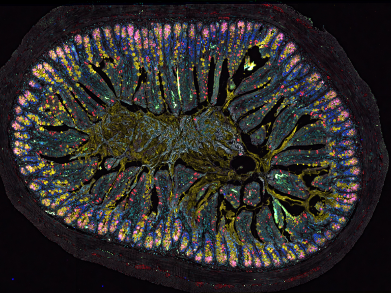 Die zentrale Rolle des «Bauchhirns» bei Allergien